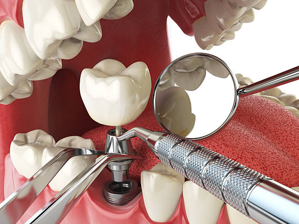 Best Emergency Denture Repair in American Falls, ID